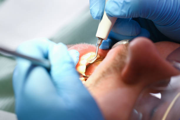 Best Emergency Root Canal Treatment in Saddle River, NJ